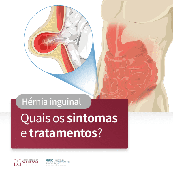 Hérnia inguinal Quais os sintomas e tratamentos Cighep