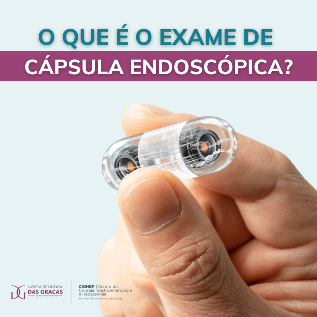 O que é o exame de cápsula endoscópica? - Cighep