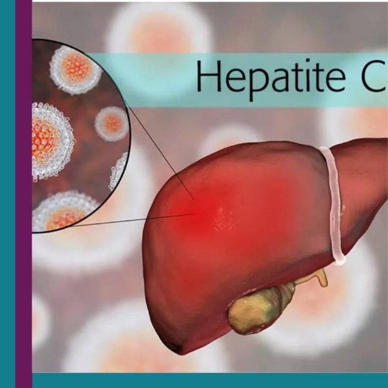 Hepatite C - Cighep