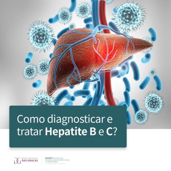Como diagnosticar e tratar Hepatite B e C? - Cighep